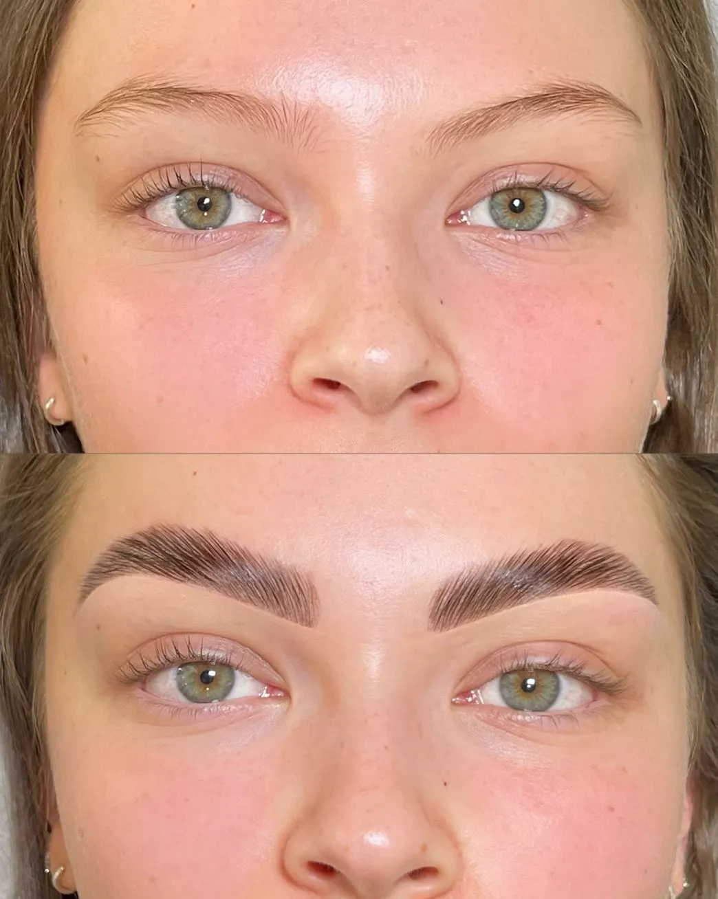Pre-existing Weak or Sparse Brows