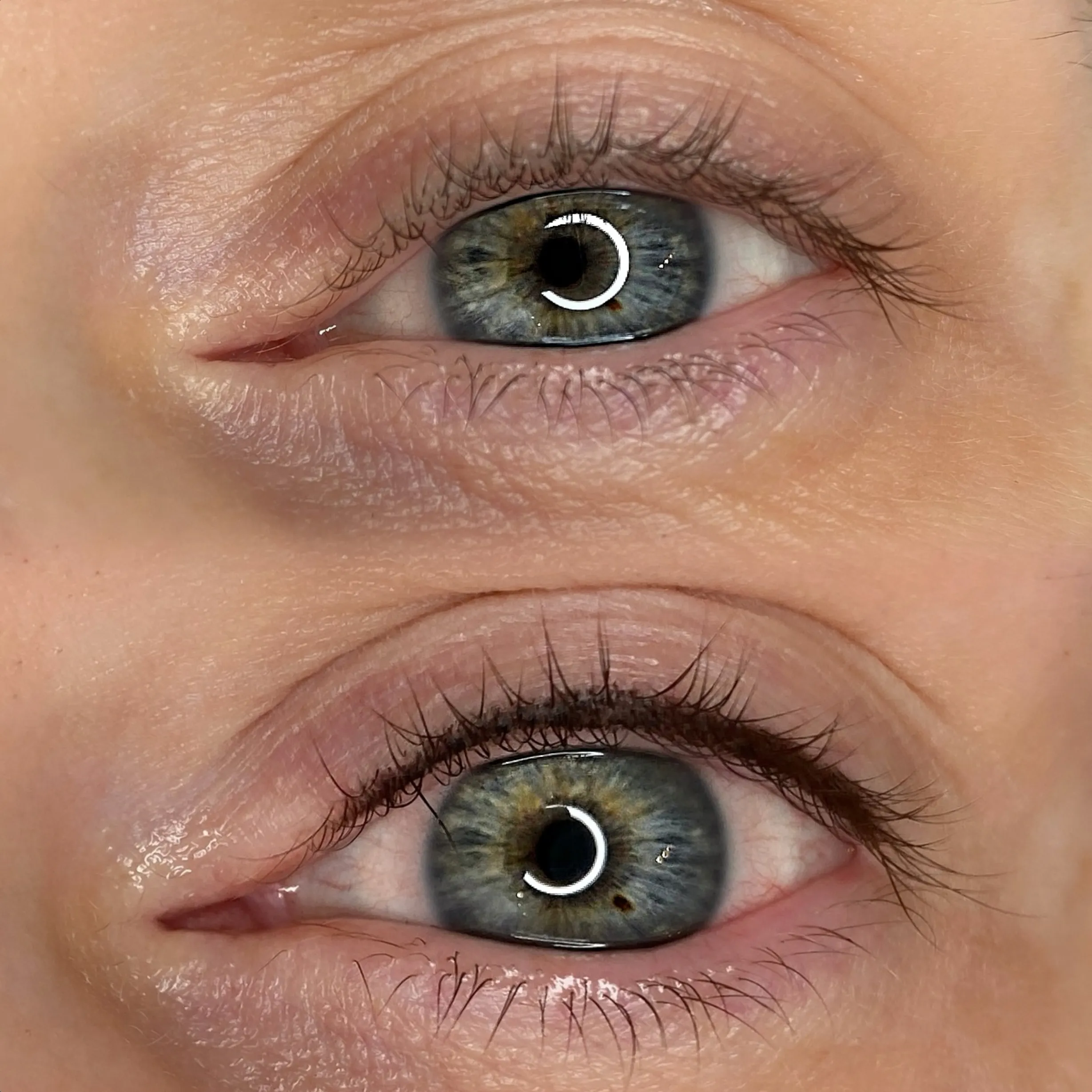 cosmetic tatooing