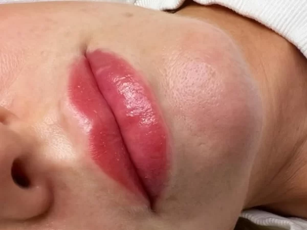 Not Candidate For Lip Blush
