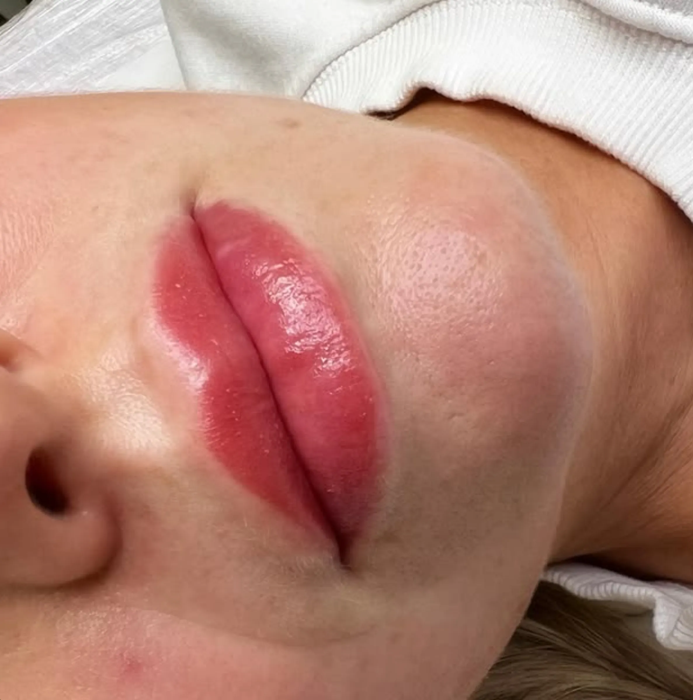 Not Candidate For Lip Blush