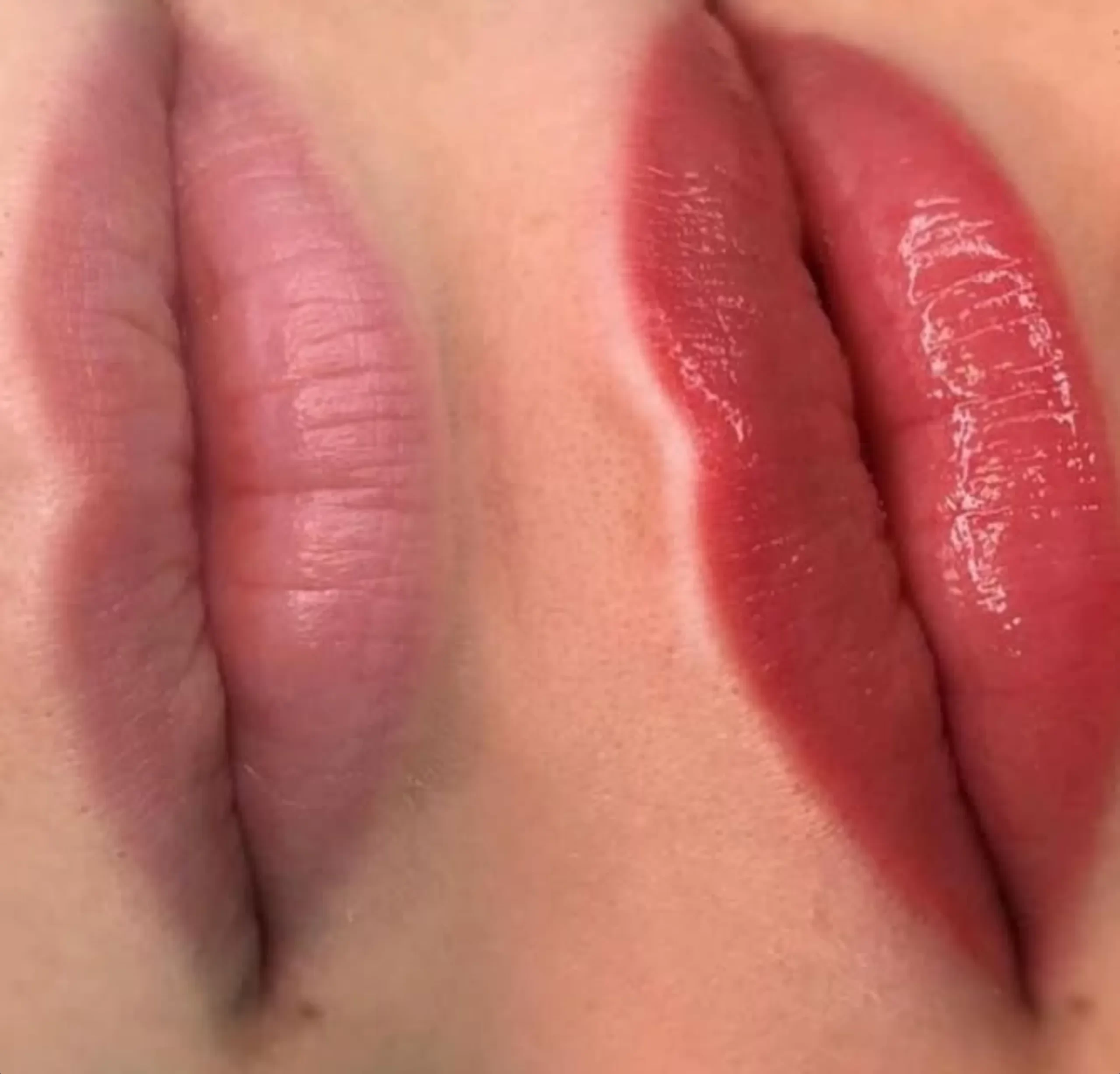 blood thinners and lip tattoo