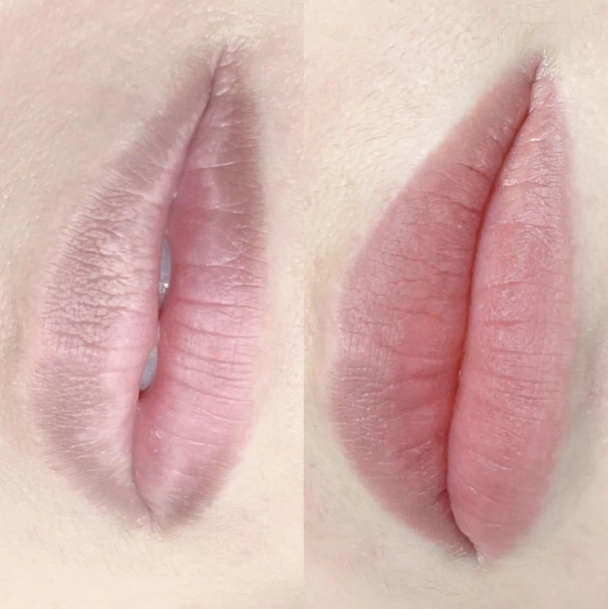 skin conditions lip tattoo