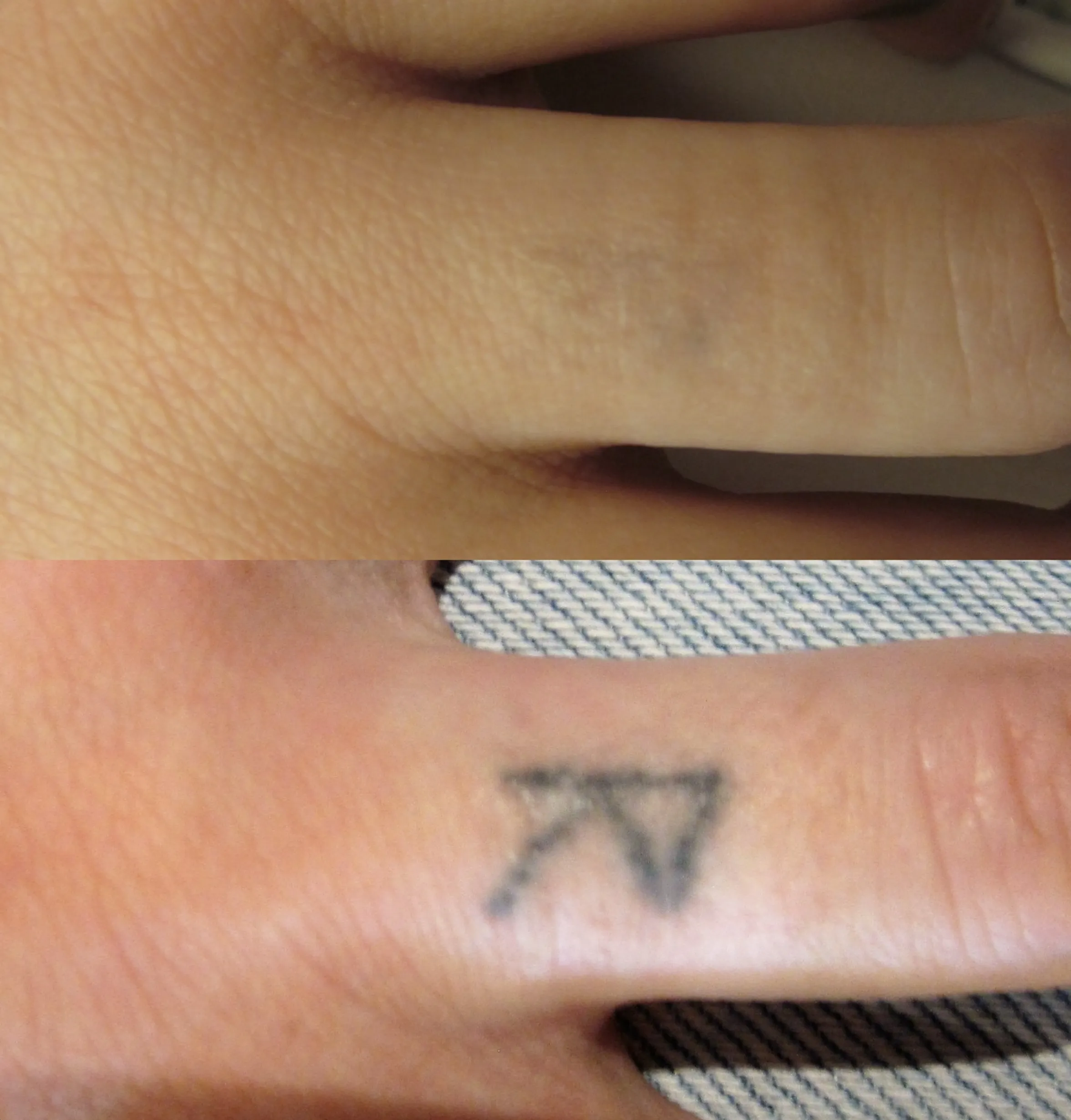 does salt remove tattoo ink