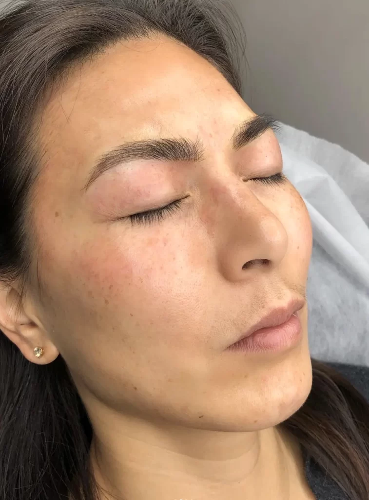 A Client Story