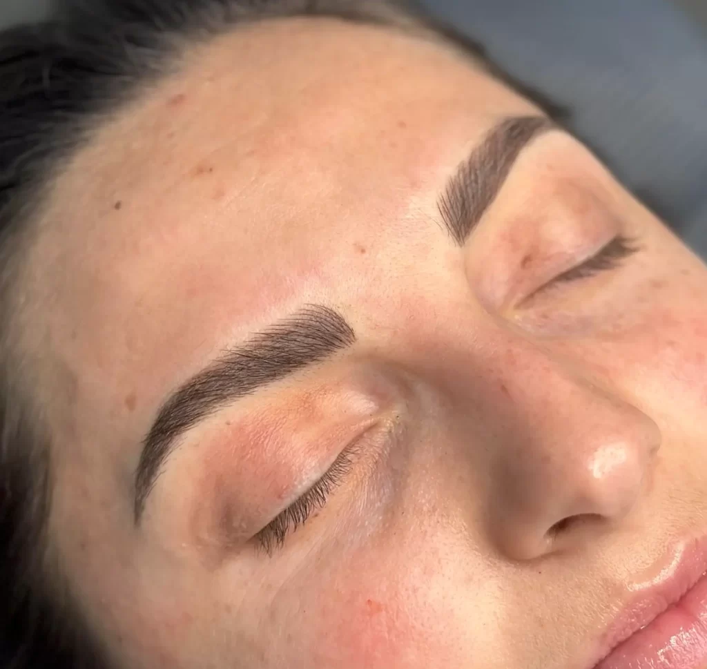 How Local Climate Influences Brow Healing