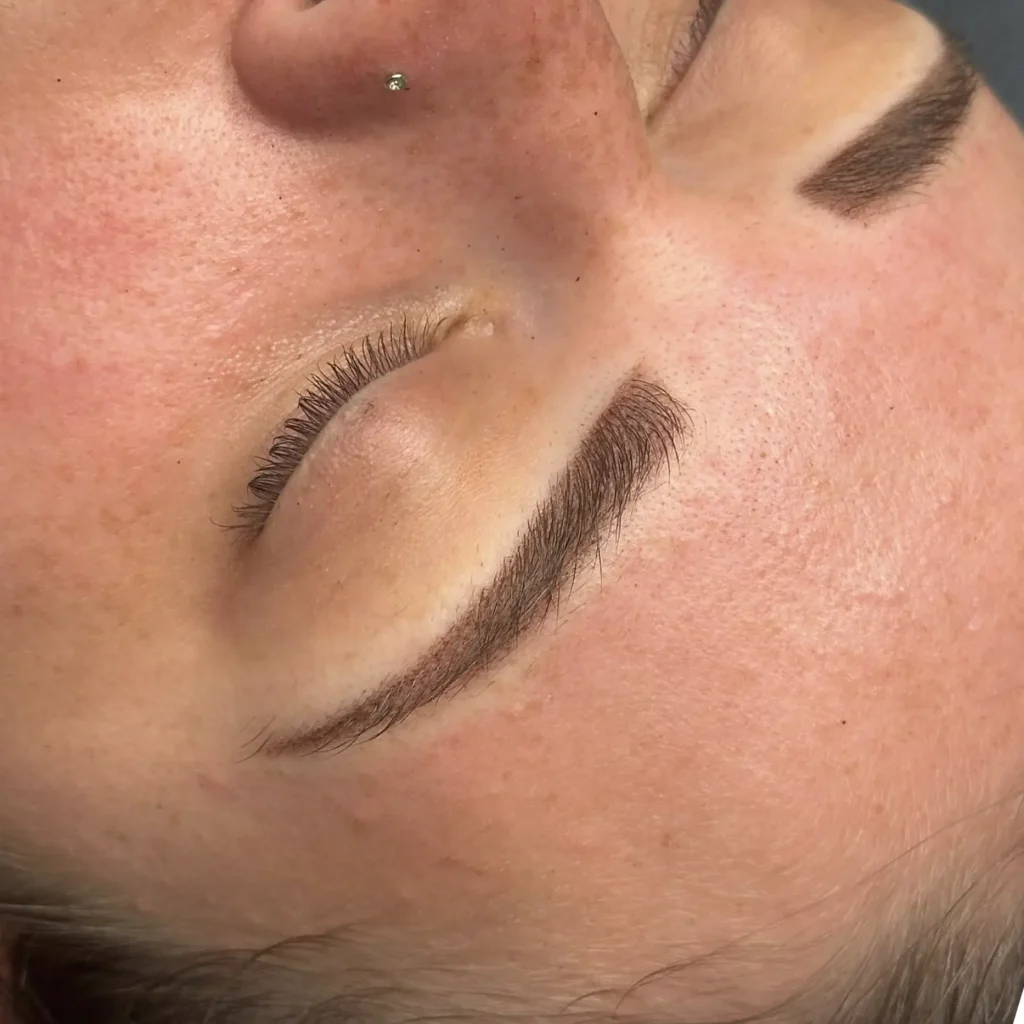 Patch Tests For Delicate Skin