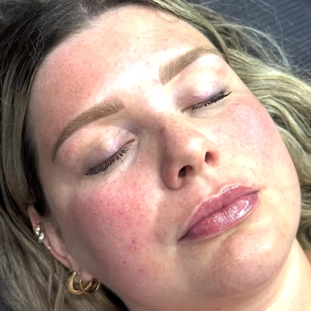 What Really Causes Cool-Toned Brow Heals