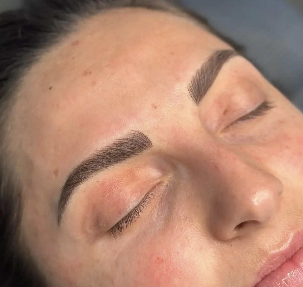 Why Reactive Skin Needs Its Own Plan